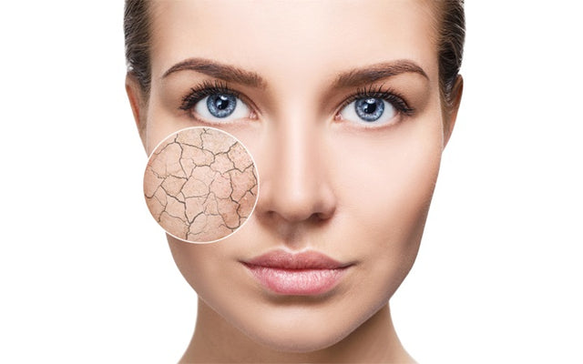 Dry Skin On The Face: Symptoms, Causes & Remedies – SkinKraft