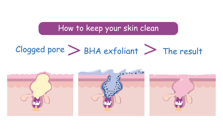 3 steps for  how to clean up clogged pores using bha salicylic cleanser exfoliant for pure skin care routine