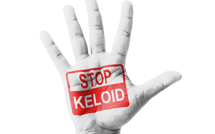 Open hand raised and showing stop keloid sign painted