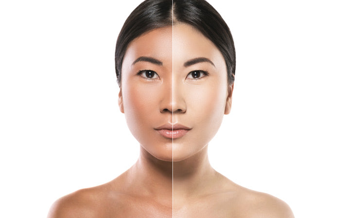 Hautbleiche vs. Hautaufhellung