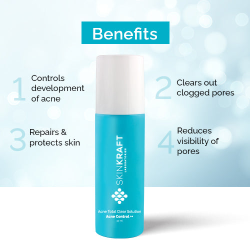 Buy Acne Total Clear Solution Online at Best Price SkinKraft