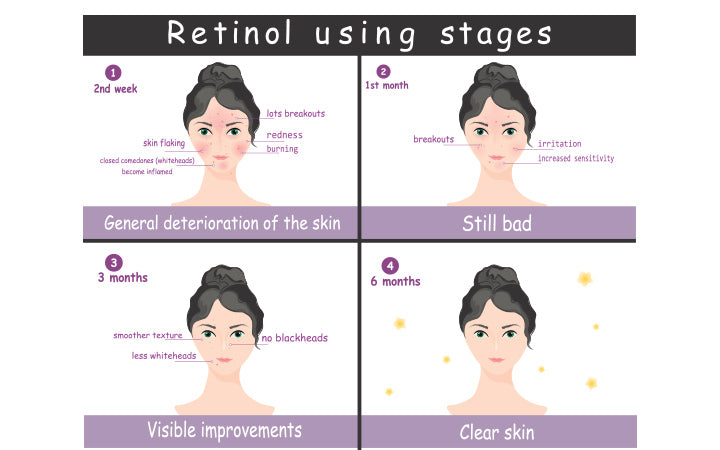 Vector poster stages of using topical retinol acne treatment