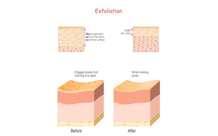 cross-section of skin layers before and after exfoliation