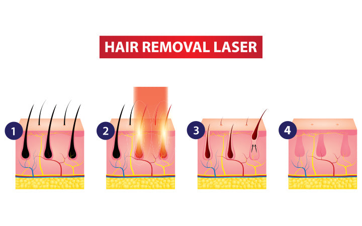 hair removal laser icon step vector illustration