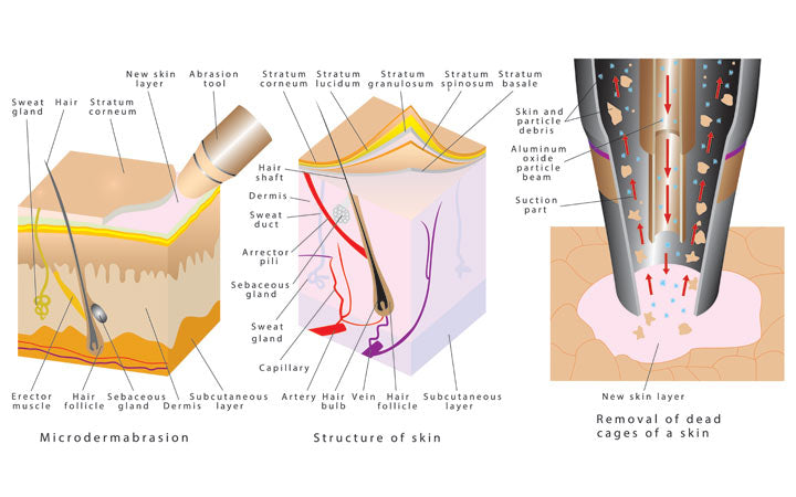 microdermabrasion diamond dermabrasion procedure repair facial skin