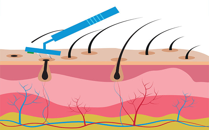 structure-of-the-skin-and-hair-removal-by-shaving