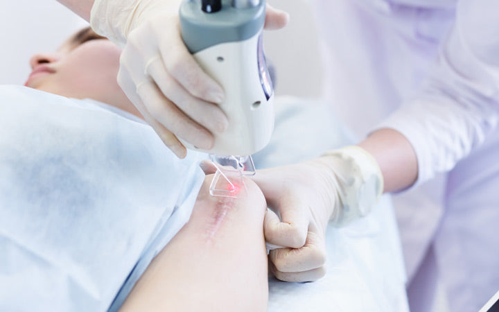 woman getting laser skin treatment