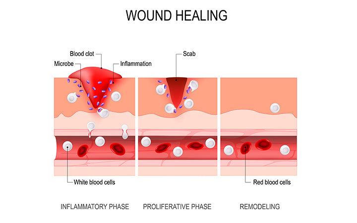 wound healing process