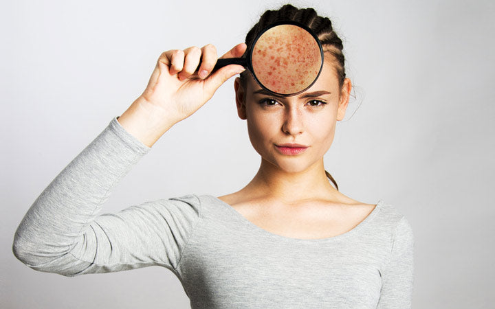 young girl having skin problems and holding magnifier face skin close up