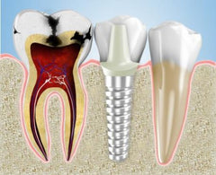 maintain-your-oral-health-with-triple-bristle