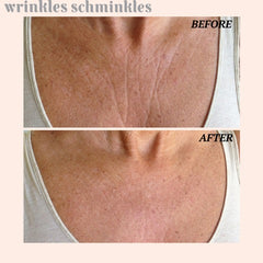 Wrinkles Schminkles Chest and Decolletage Smoothing Kit