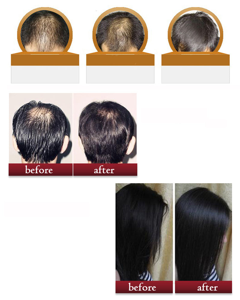Lanthome Brand Hair Care Repair Damaged Best Hair Growth Natural