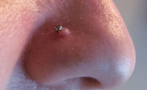 Vi ses Forkert George Bernard Nose Piercing Bumps - What Are They, and How to Get Rid of Them? – Pierced