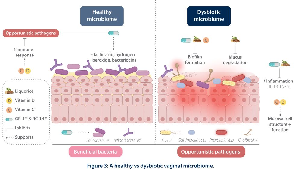 Metagenics Ultra Flora Femme 10% off RRP at HealthMasters Metagenics Figure 3 A healthy vs dysbiotic vaginal microbiome