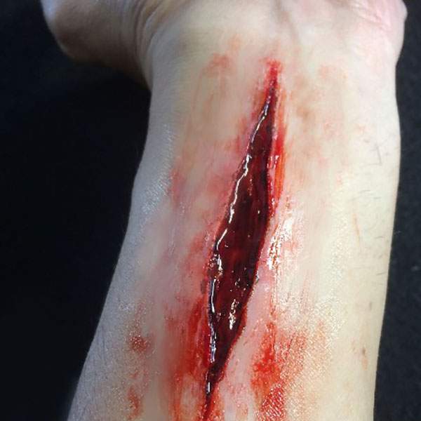 zombie wound