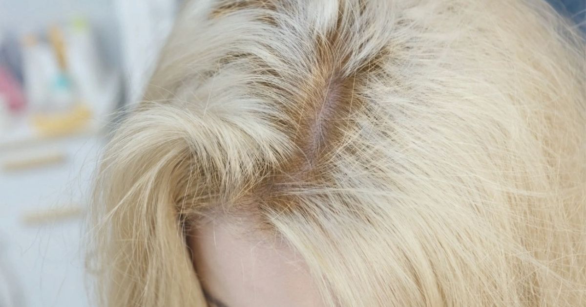 Hot Roots On Blonde Hair