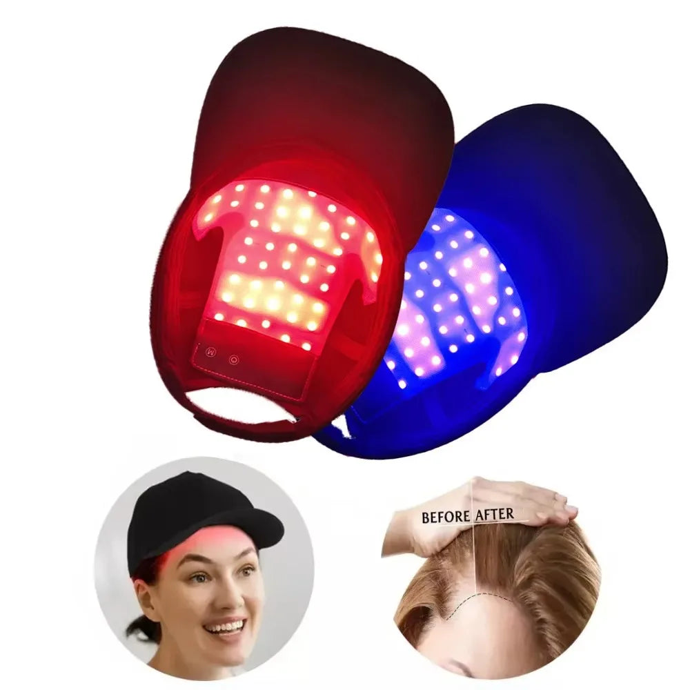 Red & Infrared Light Therapy Cap | Hair Growth & Loss Treatment Device USB