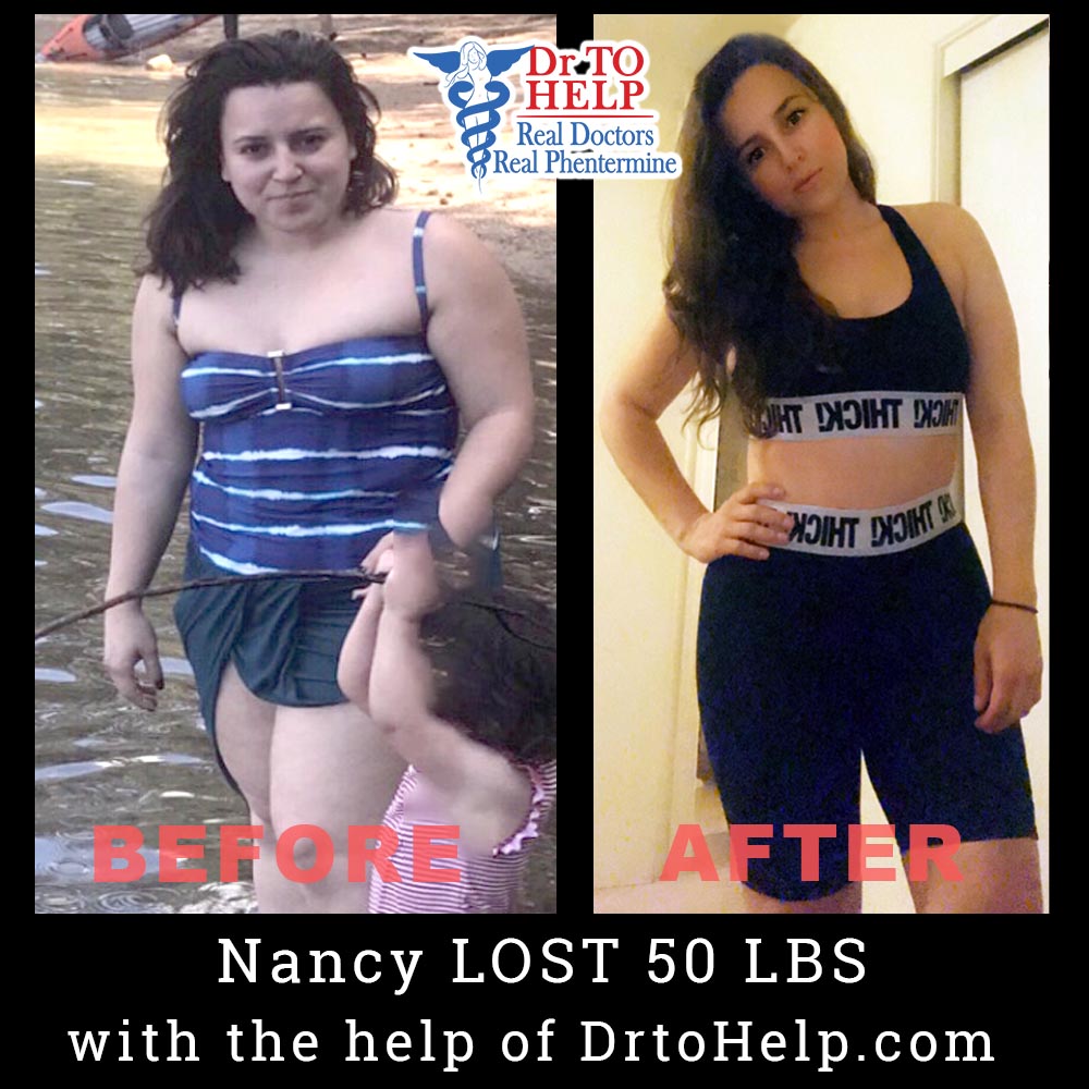 Weight loss phentermine doctor