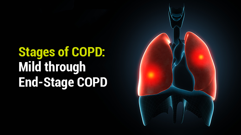 Stages Of Copd Symptoms