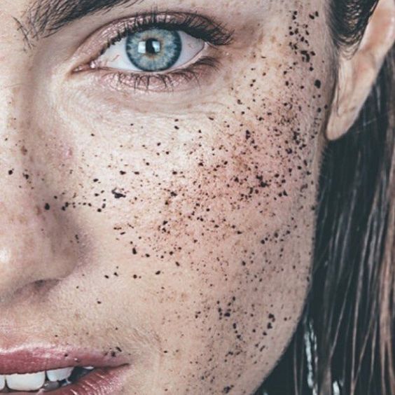 Top 104+ Images pictures of blackheads on black skin Full HD, 2k, 4k