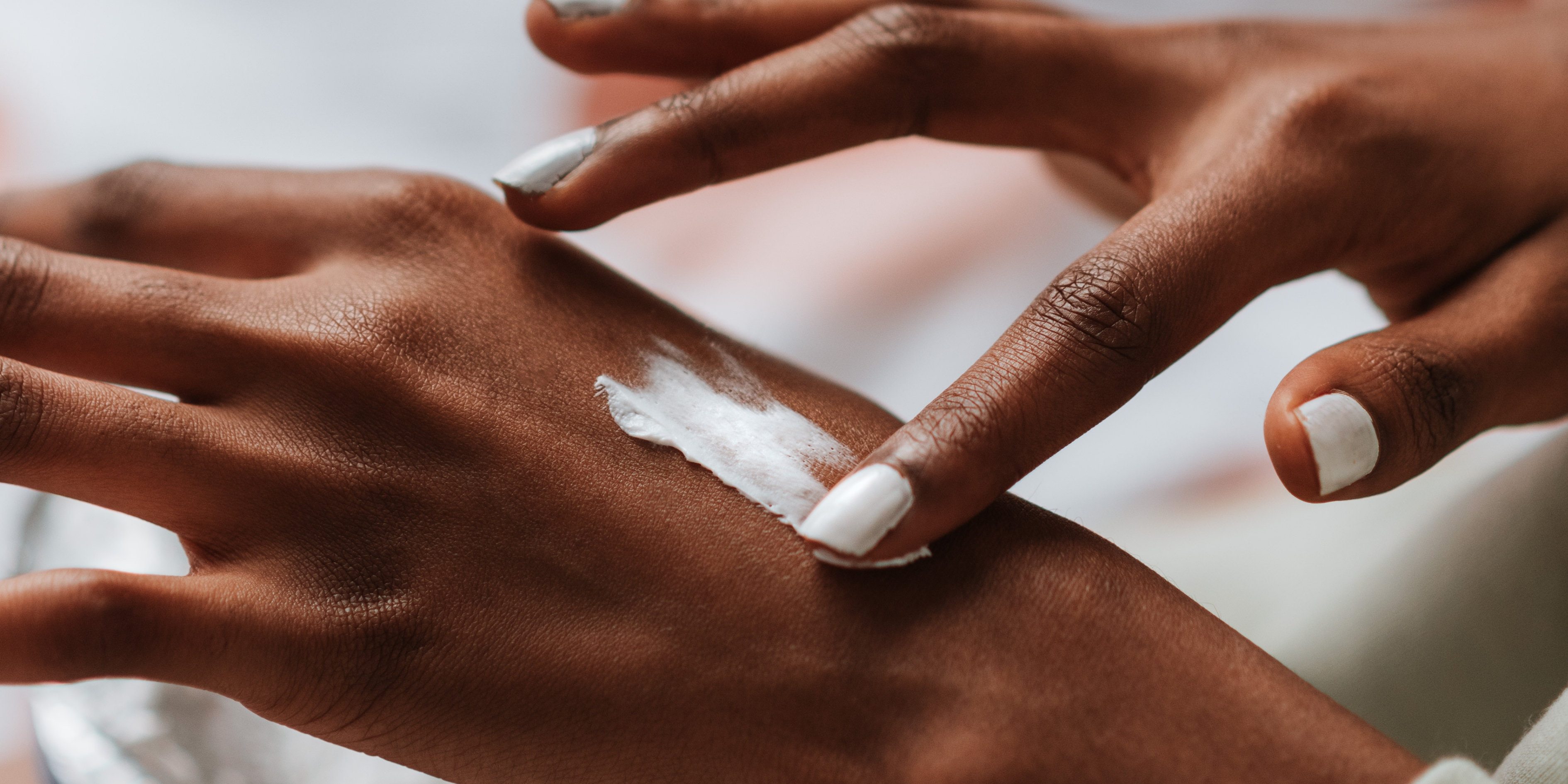 Moisturiser being applied to a hand to heal, soothe and strengthen sensitised skin 