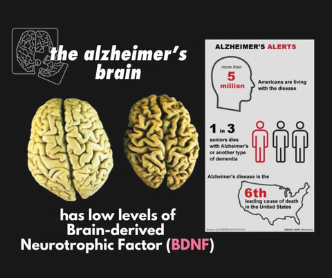 Protect your brain against Alzheimer's and other types of dementia by keeping your BDNF levels high.