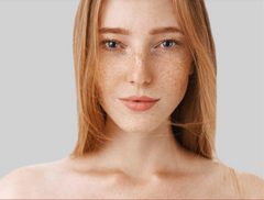 Melasma treatment