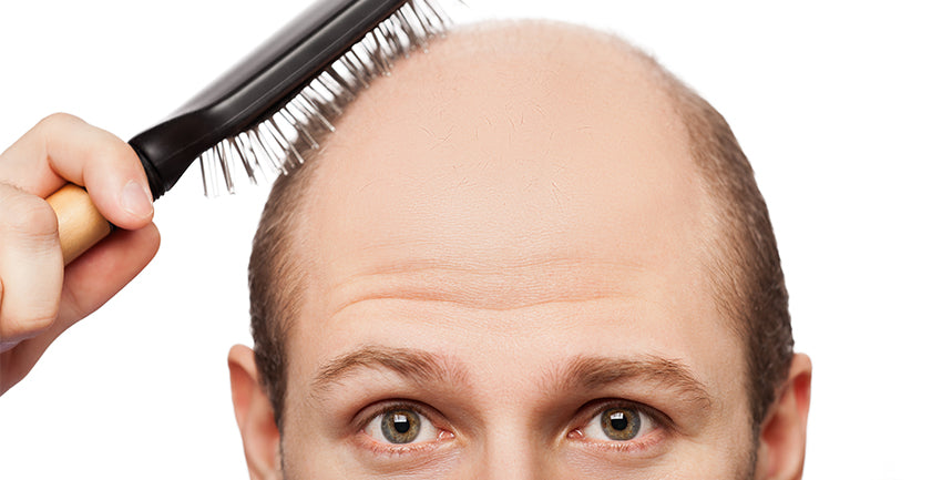 hair loss quality of life