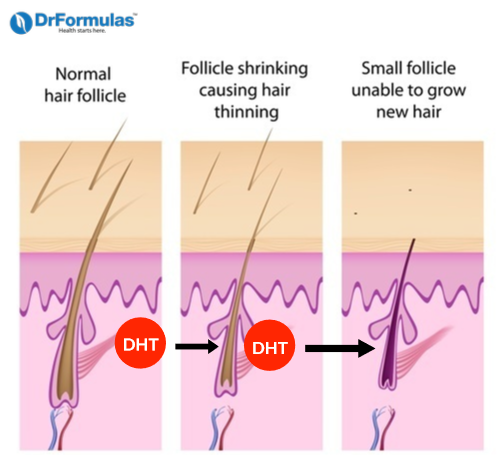 how does finasteride work for hair loss