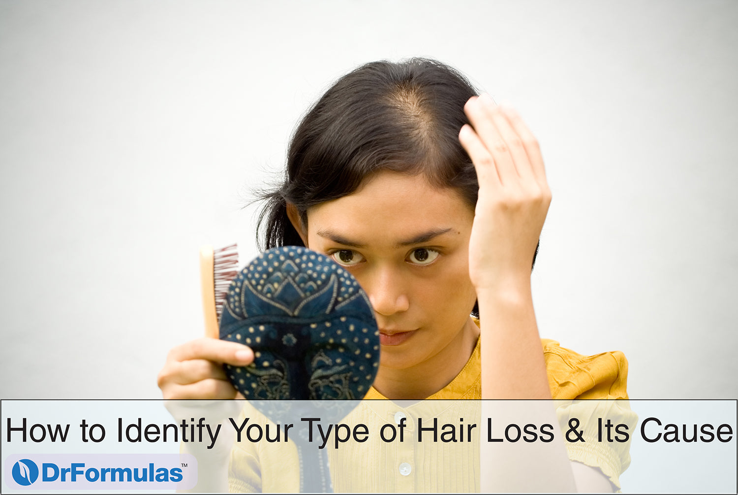 How To Identify Your Type Of Hair Loss And Its Cause DrFormulas