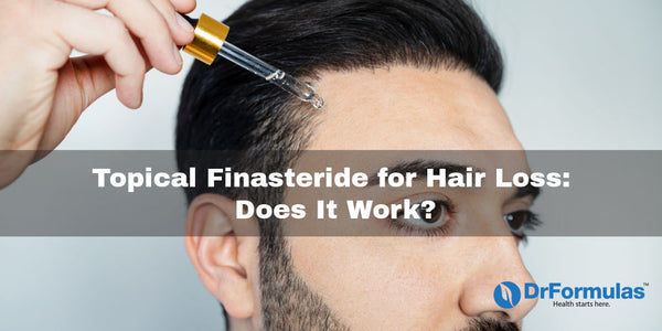 Topical Finasteride for Hair Loss: Does It Work? –