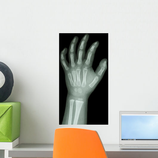 X-Ray Infants Hand 