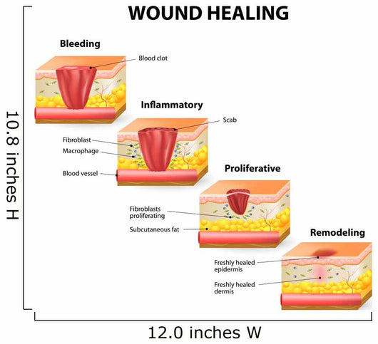 Wound Healing Diagram Wall Mural  U2013 Wallmonkeys Com