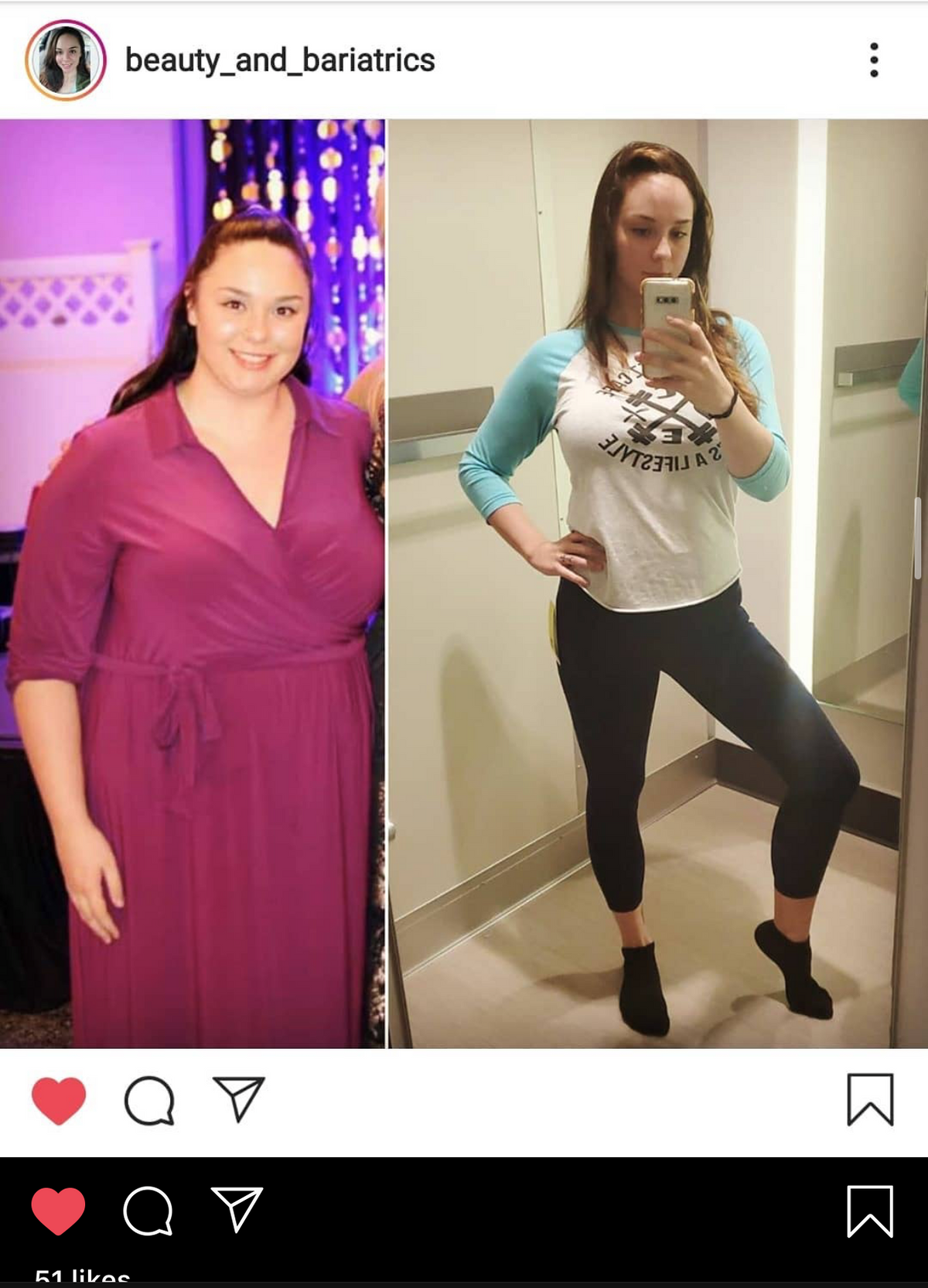 Before and After Clean Eatz Weight Loss Success Story