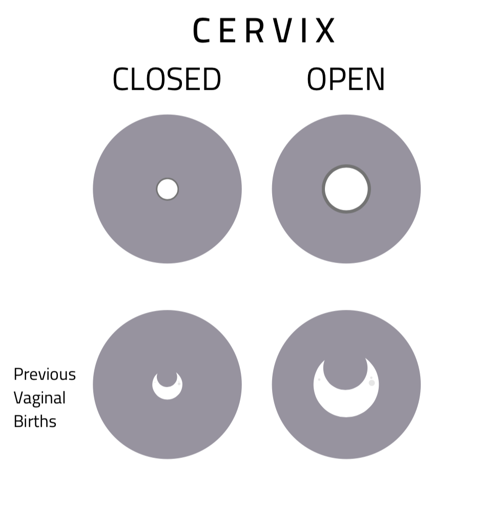 Cervix Position, Cervix