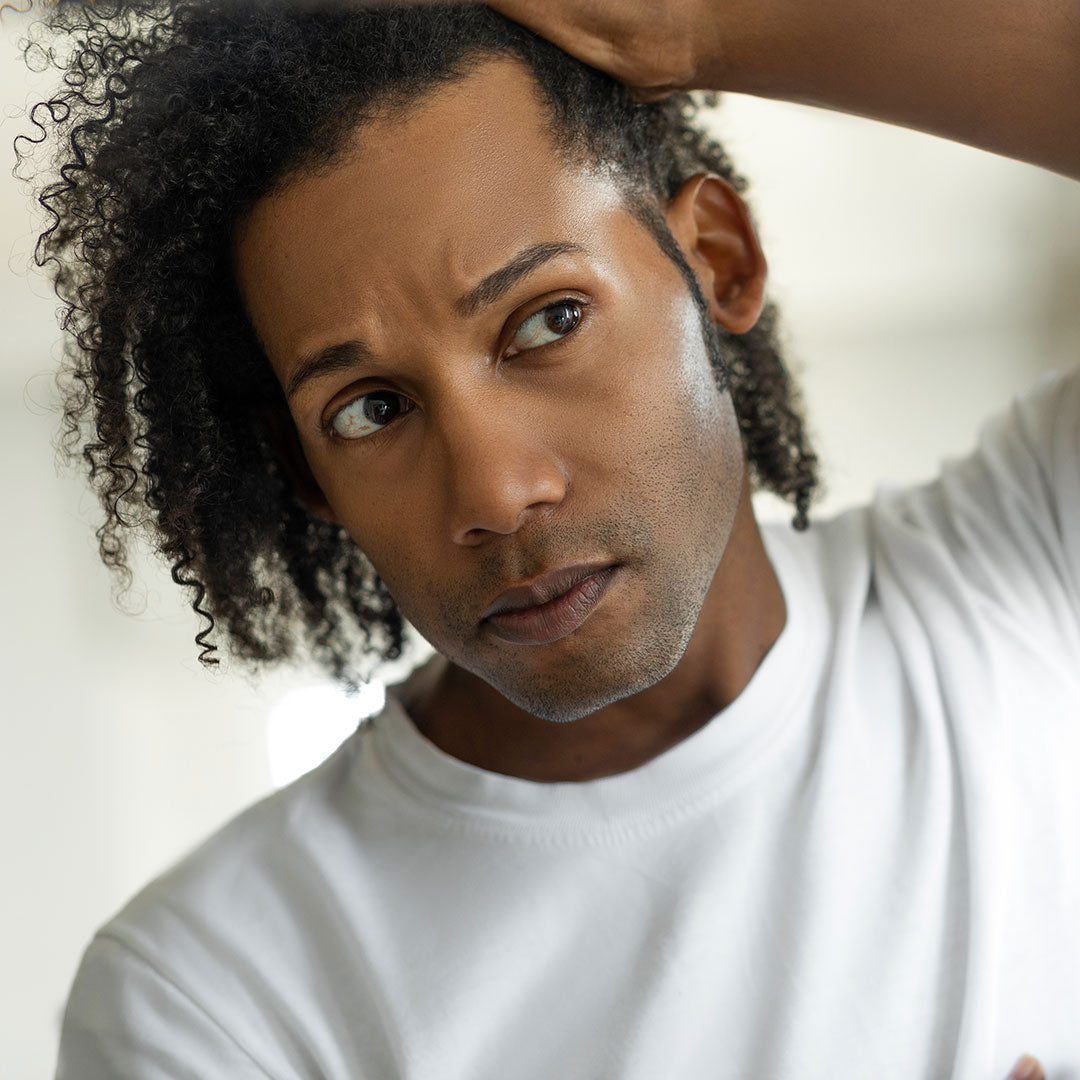 Man worried for alopecia checking hair for loss