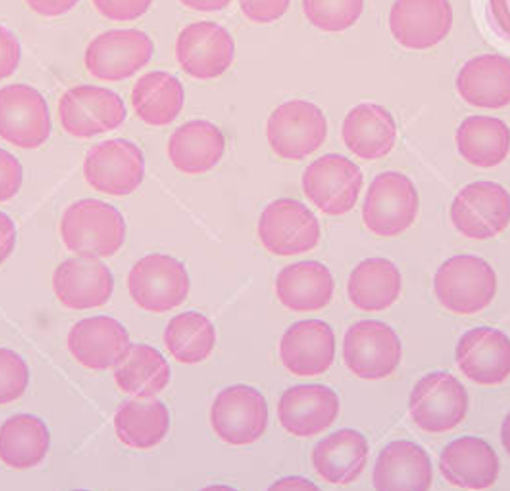 normal red blood cells