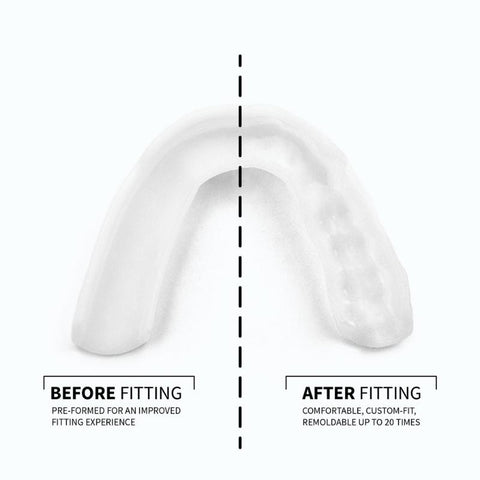 Affordable Thin Night Guard: SOVA Aero Night Guard for Teeth Grinding –  APAC Dental