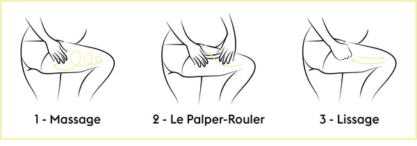 vergetures cuisses et fesses