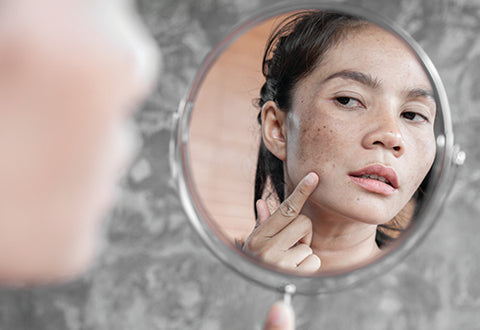 Skin discoloration is a common condition with a variety of underlying causes.