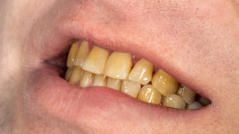 why-teeth-discolor-and-how-to-prevent-and-reverse-it.jpg__PID:77b0e965-5081-46ef-a0a0-82b967d616c5