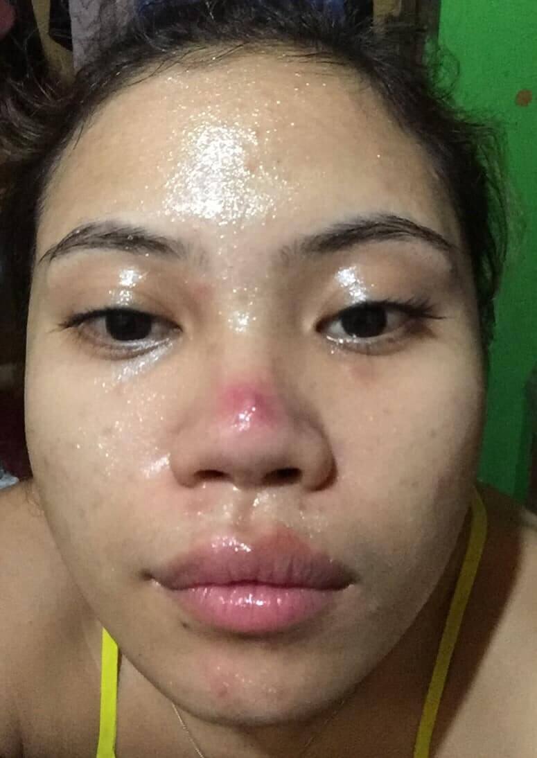 Luxxe Protect for face