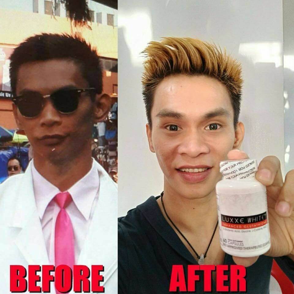 luxxe white glutathione good for black skin