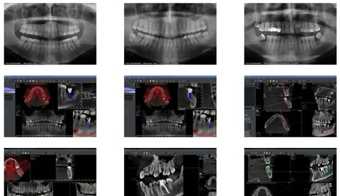 Owandy I-MAX Touch 3D Cone Beam and Panoramic X Ray