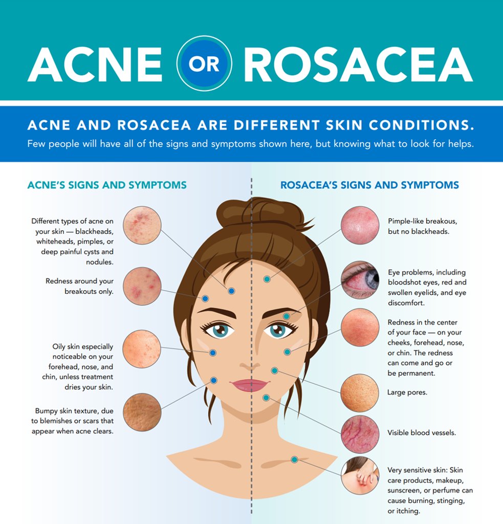 This or That? The Acne vs. Rosacea Version | Hero Cosmetics