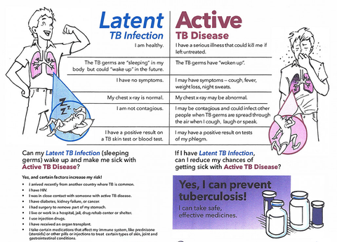 latent active tb