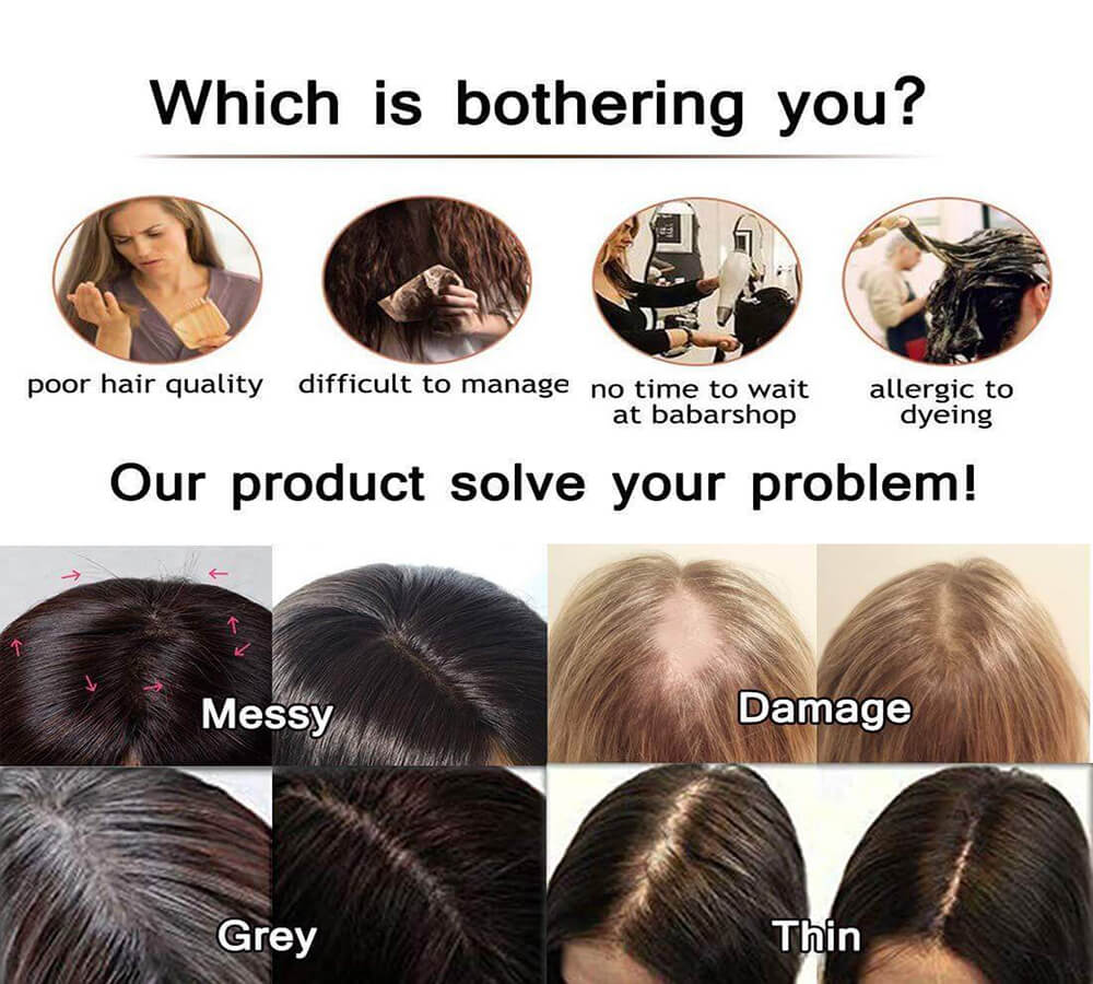 Topper hilft Ihnen, Haarprobleme zu lösen