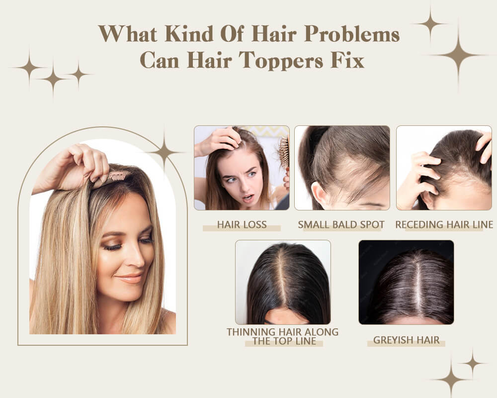 What kind of hair problems can hair toppers fix