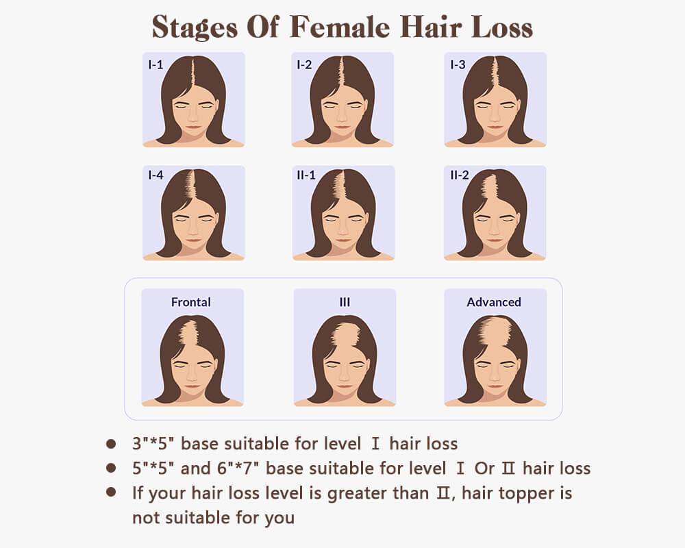 The degree of your hair loss