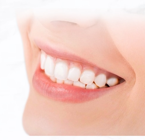 Why Use Invisible Braces?